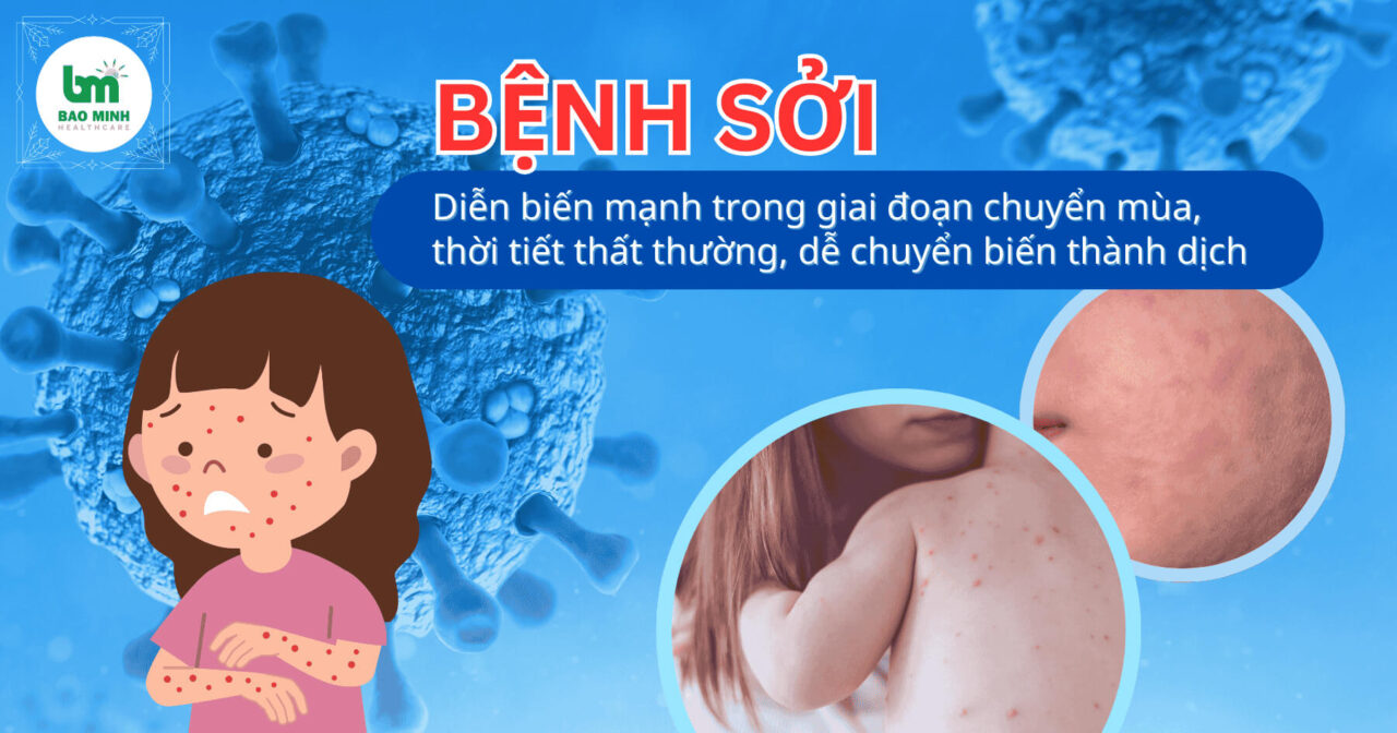 Phòng bệnh sởi