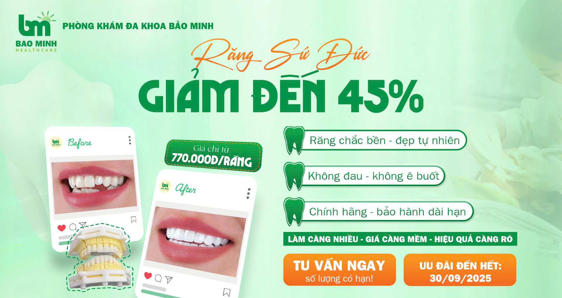 Ưu đãi răng sứ