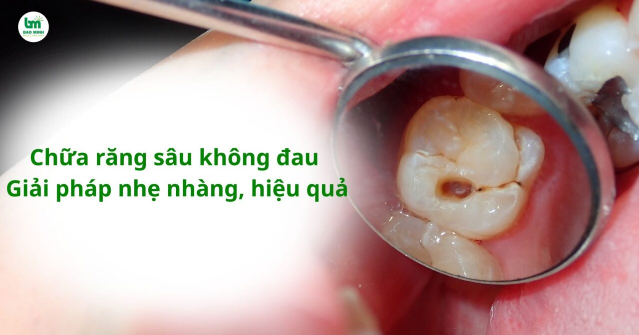 Chữa răng sâu không đau giải pháp nhẹ nhàng hiệu quả