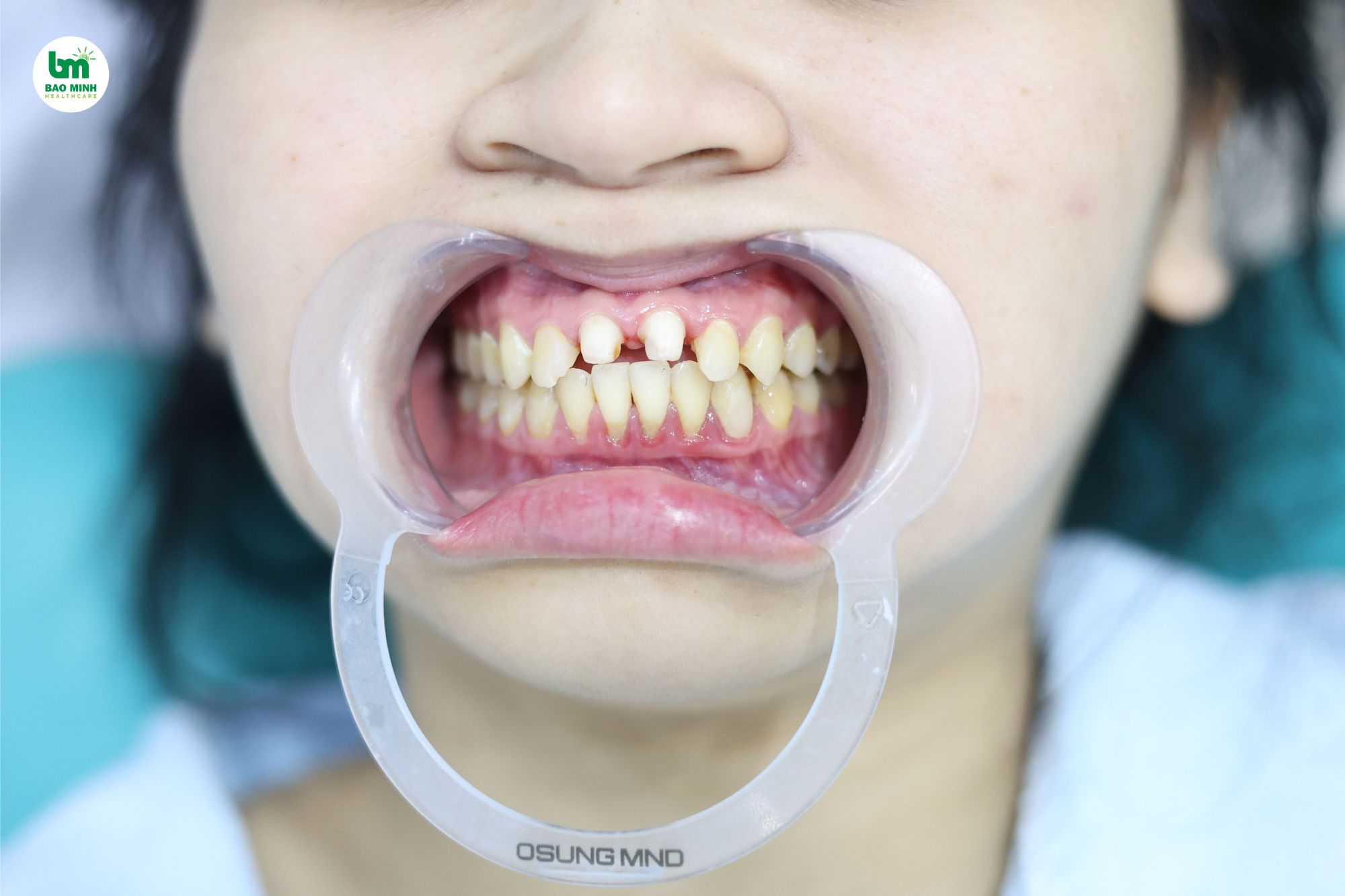 Dịch vụ thường có tại phòng khám răng miệng chất lượng