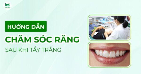 Hướng dẫn chăm sóc răng sau khi tẩy trắng