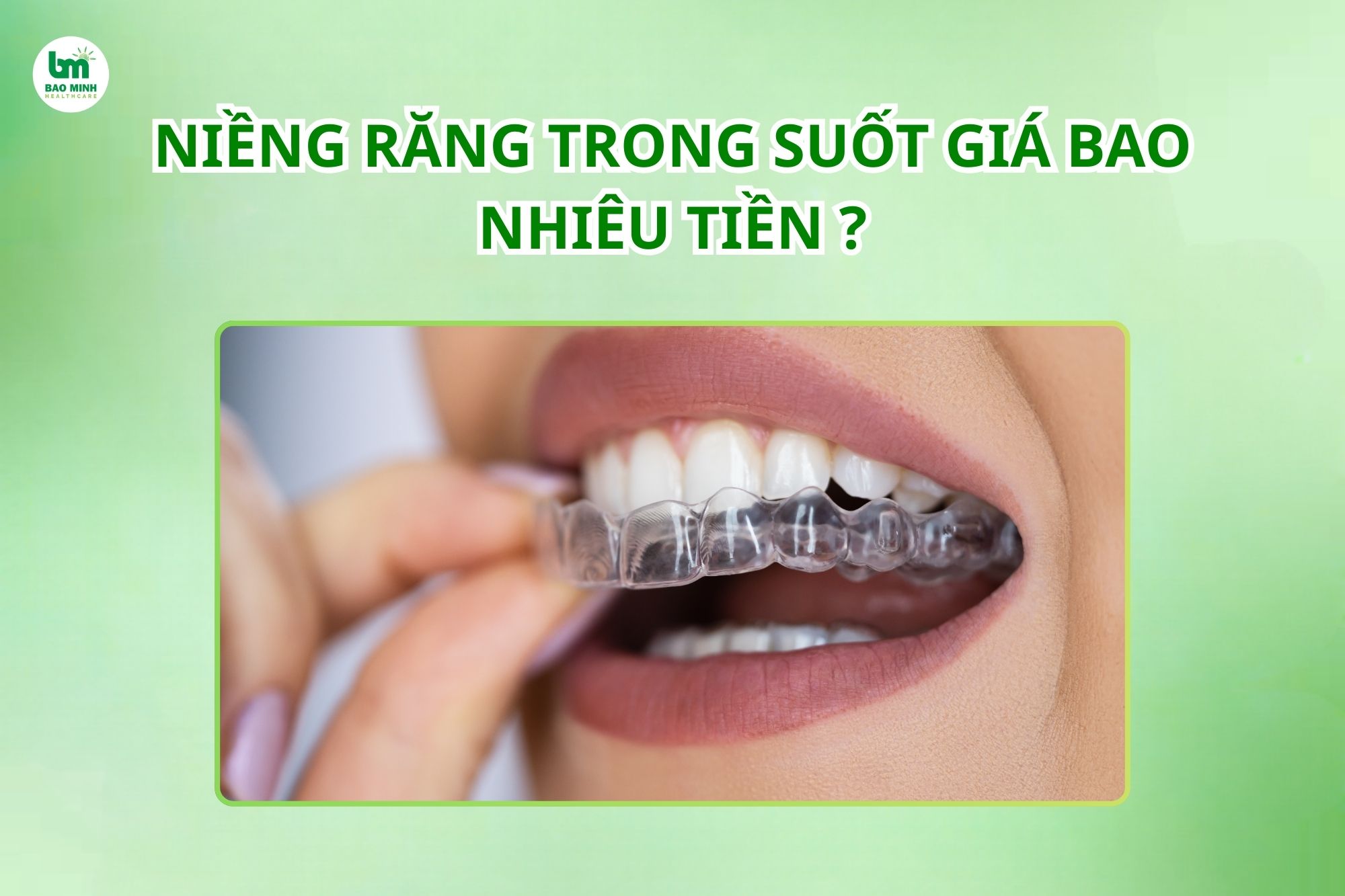 Niềng răng trong suốt giá bao nhiêu tiền
