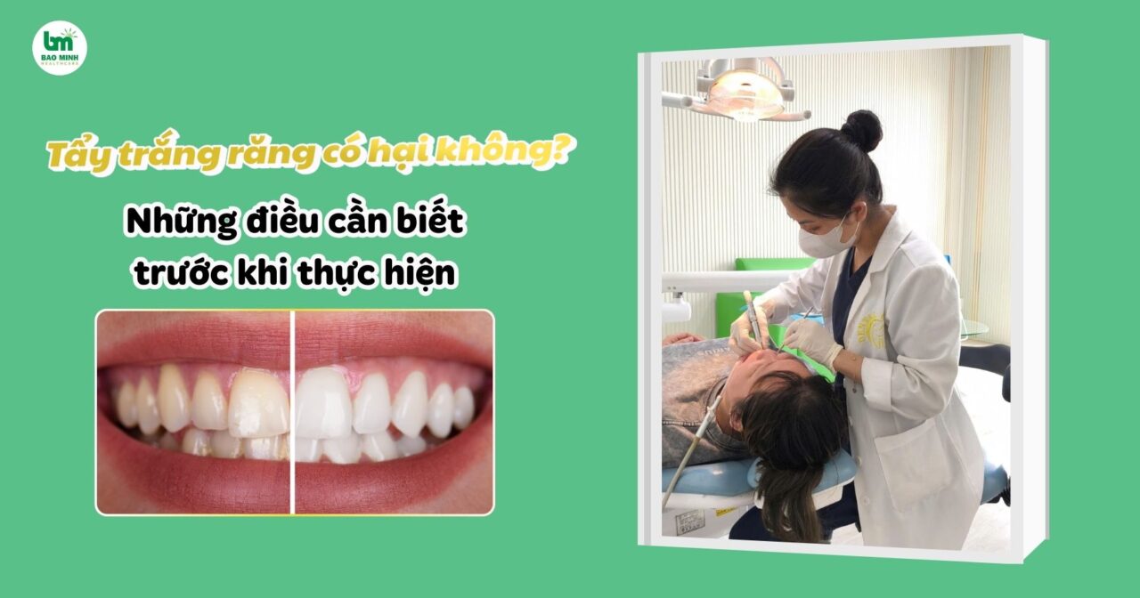 Tẩy trắng răng có hại không? Những điều cần biết
