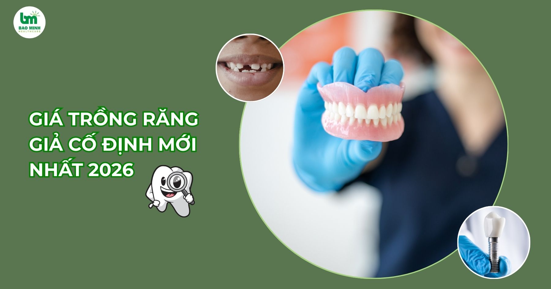 Giá trồng răng giả cố định mới nhất 2026
